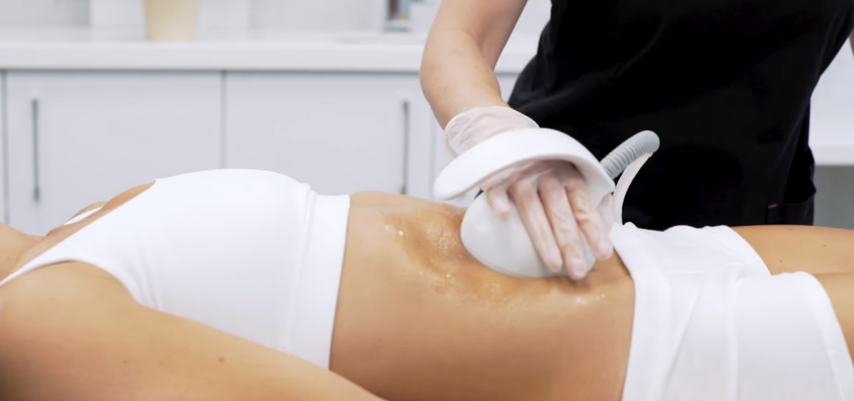 Venus MP2 body contouring treatment